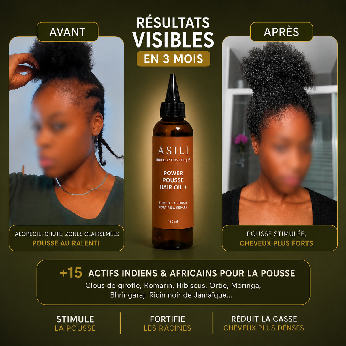 Huile Ayurvédique pousse Asilì