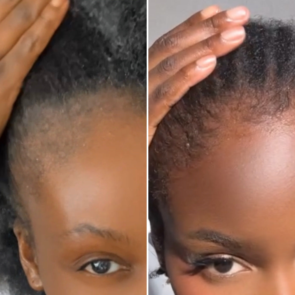 Duo Huile & Baume Pousse Asilì | Routine Croissance Cheveux Crépus