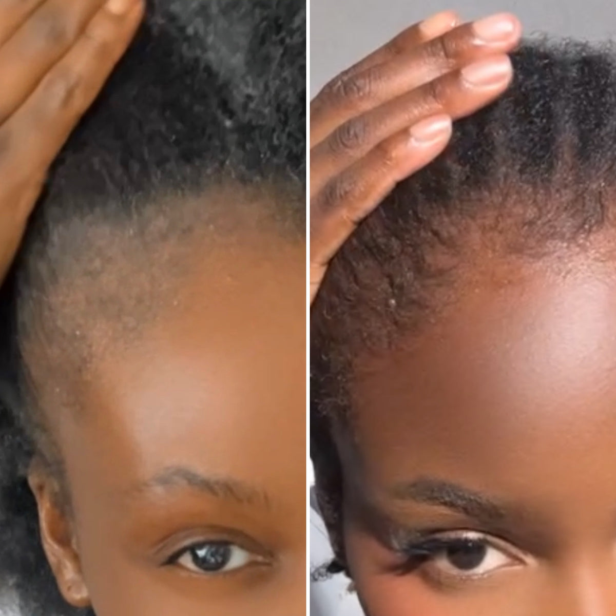 Duo Huile & Baume Pousse Asilì | Routine Croissance Cheveux Crépus